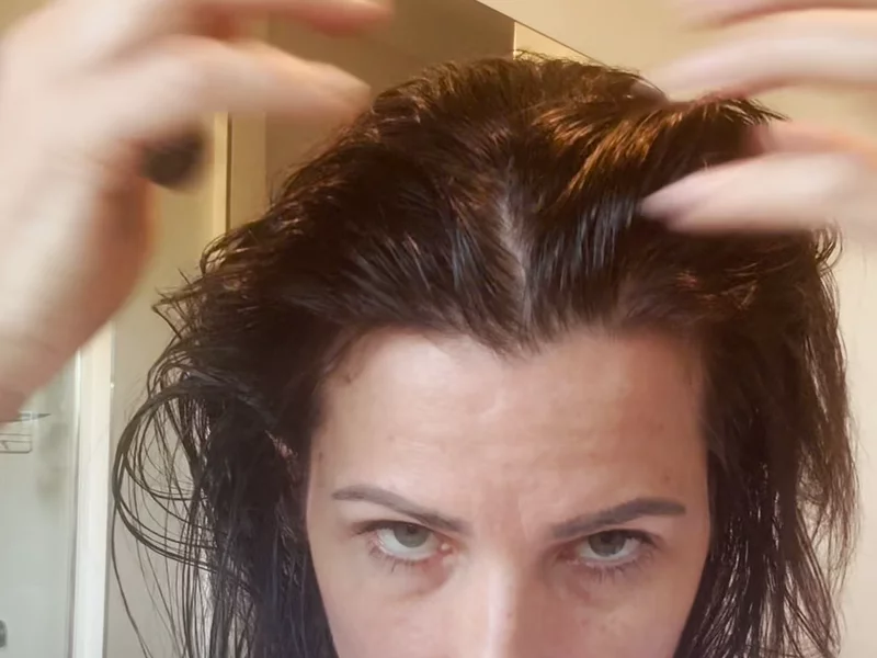 Kn10 Hair growth journey