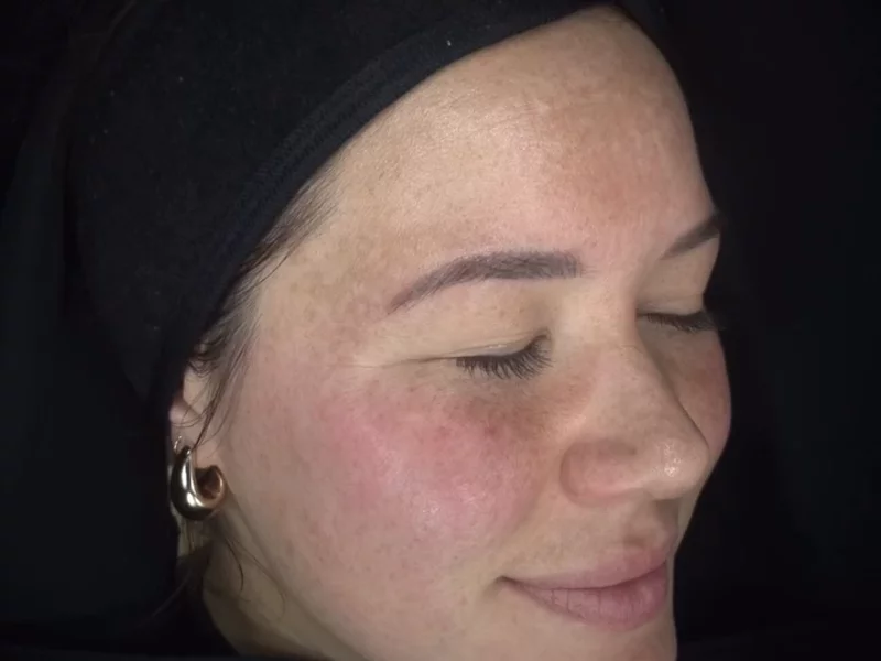 Skin Health 101