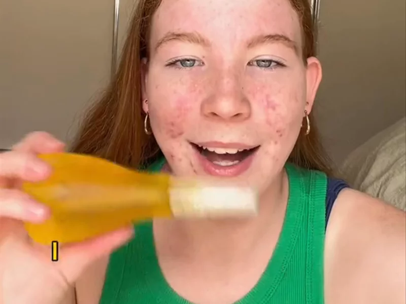 Skincare testimony with before and after