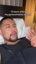@thejonmichael, surgery-day gynecomastia recovery