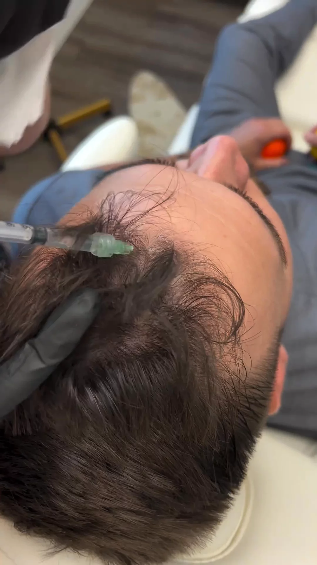 James' in-office treatment