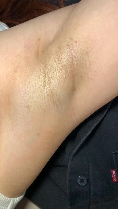 Paste the Sugar Place - After sugaring - Sugaring Near Me - Anaheim, California