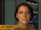 A New York practice’s combined-treatment testimonial