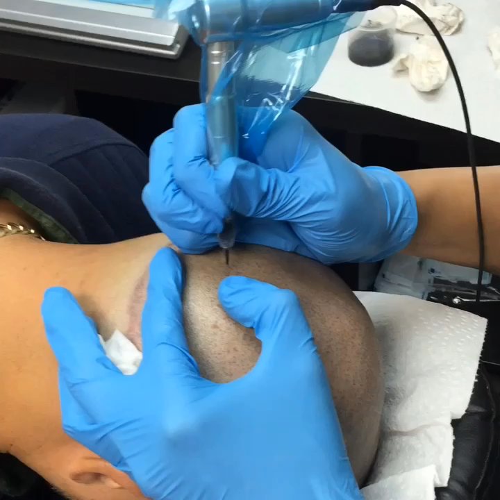 Scalp Evolution - Hair Loss Centers Near Me - Miami, Florida
