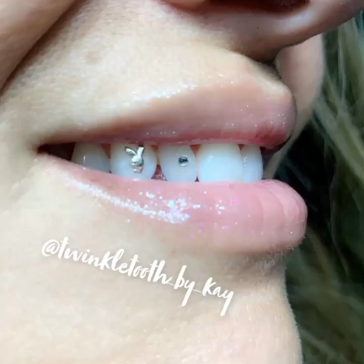 Twinkletooth By Kay - Added this playboy bunny - Teeth Whitening Near Me