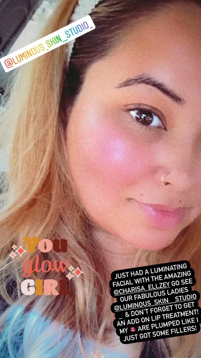 Luminous Skin Studio - Microdermabrasion, add on lip treatment, and dermoplaning left my skin gleaming!! - Skin Care Near Me - Santa Clara , California
