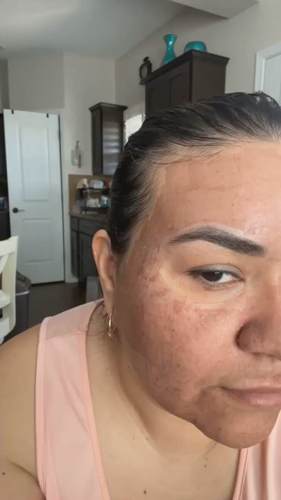 Khronos MedSpa - CO2 - Aestheticians Near Me - San Antonio, Texas