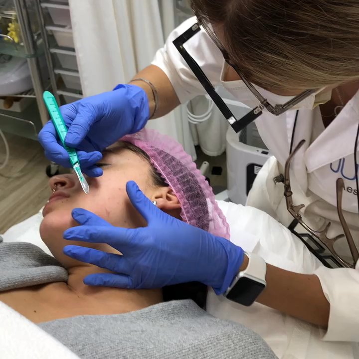 Juvia Aesthetics - This is one of our latest procedures, it's called dermaplanning it removes peach fuzz and at the same time exfoliates away dry skin.. - Skin Care Near Me - Wayne New Jersey, New Jersey