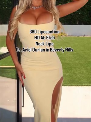 Neck Lift result at Ourian Plastic Surgery