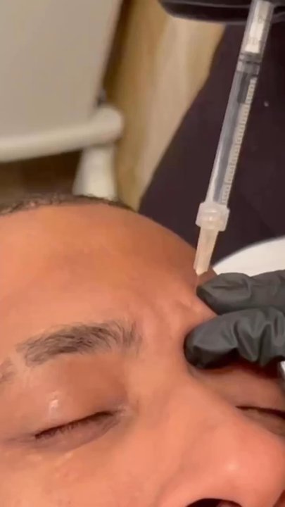 Omega Beaute - MEN - no more wrinkles! - Skin Care Near Me - Long Beach, California