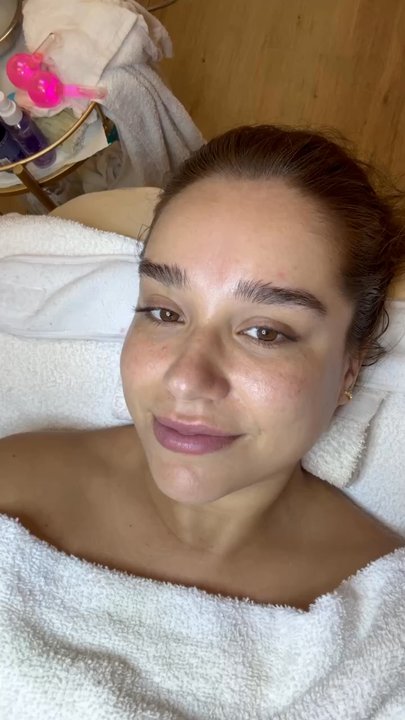 Radiance Skincare - Fresh after facial!!! Love my results - Skin Care Near Me - Tustin, California