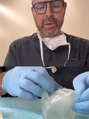 Breast Augmentation result at Dr. York Yates Plastic Surgery