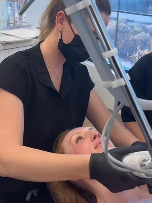 Rhinoplasty result at Utah Facial Plastics & UFP Hair Restoration