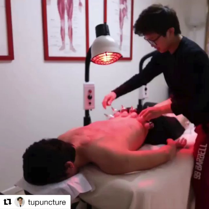 Jenny Tu Acupuncture - Acupuncture Near Me - Arcadia, California