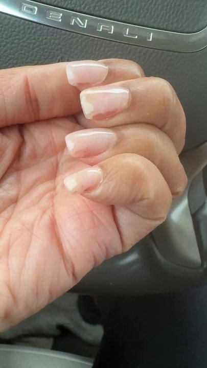 Nail Star - I went back in and this was the "result" - Nail Salons Near Me - Calera, Alabama