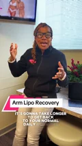 @drlissa_thebodysnatcher, arm liposuction recovery explanation