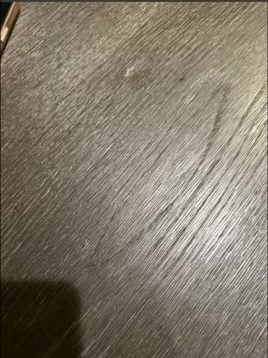 Green Bee Laser - Damaged veneer - Damage Restoration Near Me - Gardena, California