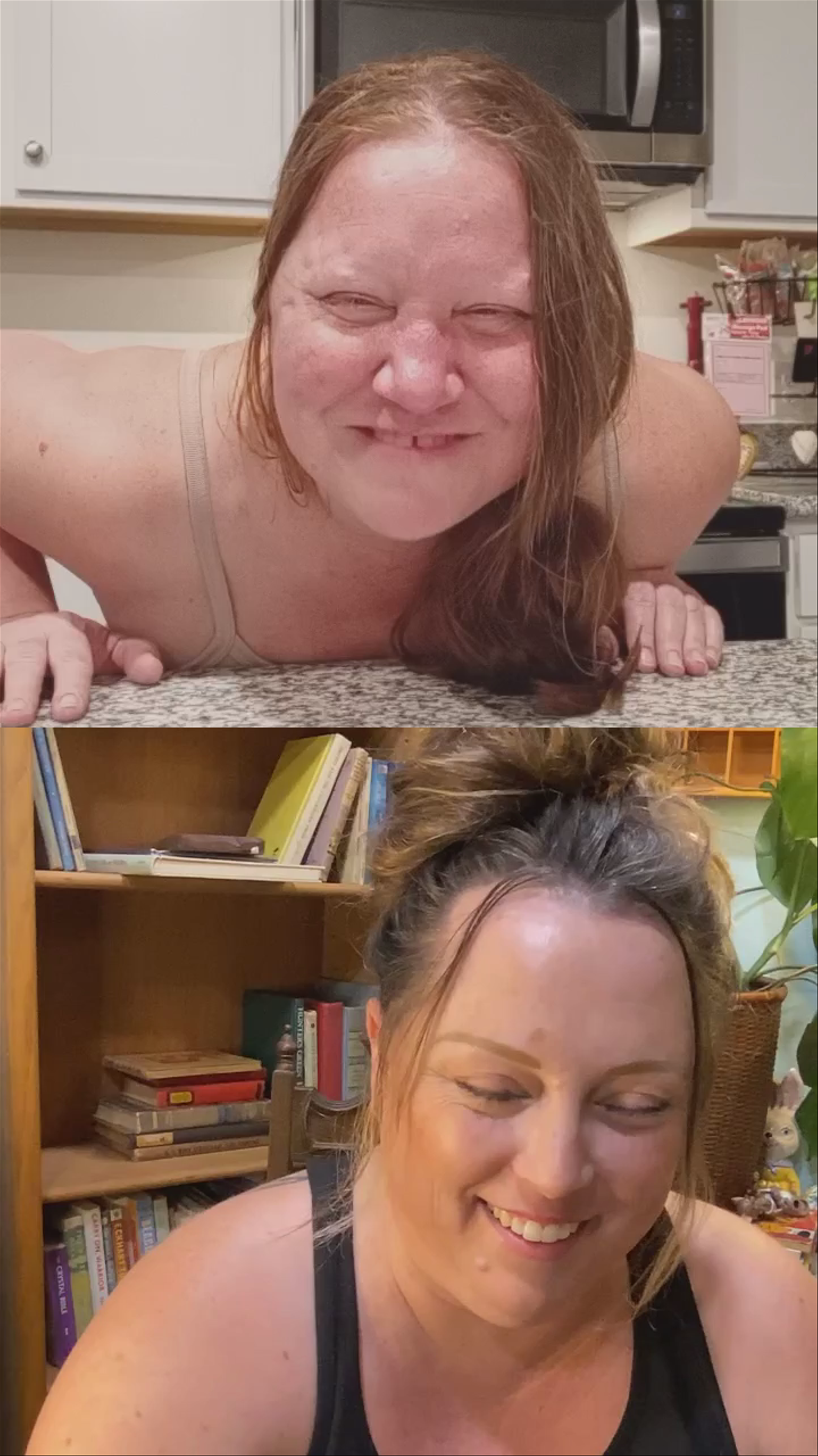 Nipples