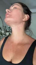 @wolfeofrealestate, day 14 after a facelift and neck lift