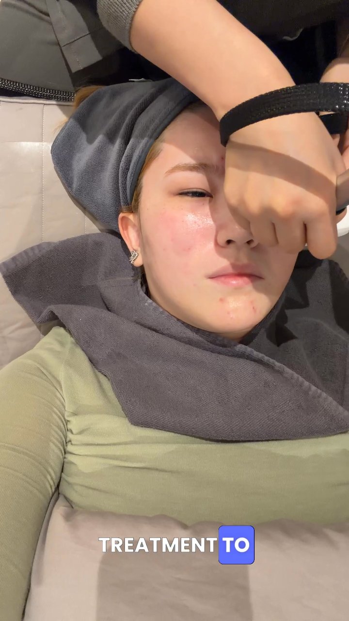 MAMBETALIEVA MALIKA ERKUL KIZI — Treatment Review at Seoul SY Dermatology