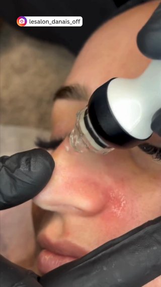  - vidéo