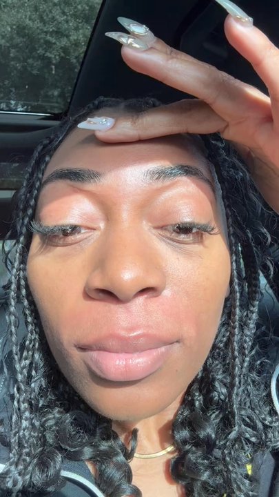 Fiona's Threading Studio - Bruises from threading too hard - Threading Services Near Me - Pasadena, California
