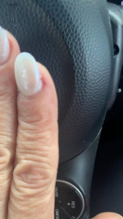 Sunshine Nail & Spa - Horrible job on my nails - Nail Salons Near Me - Everett, Washington