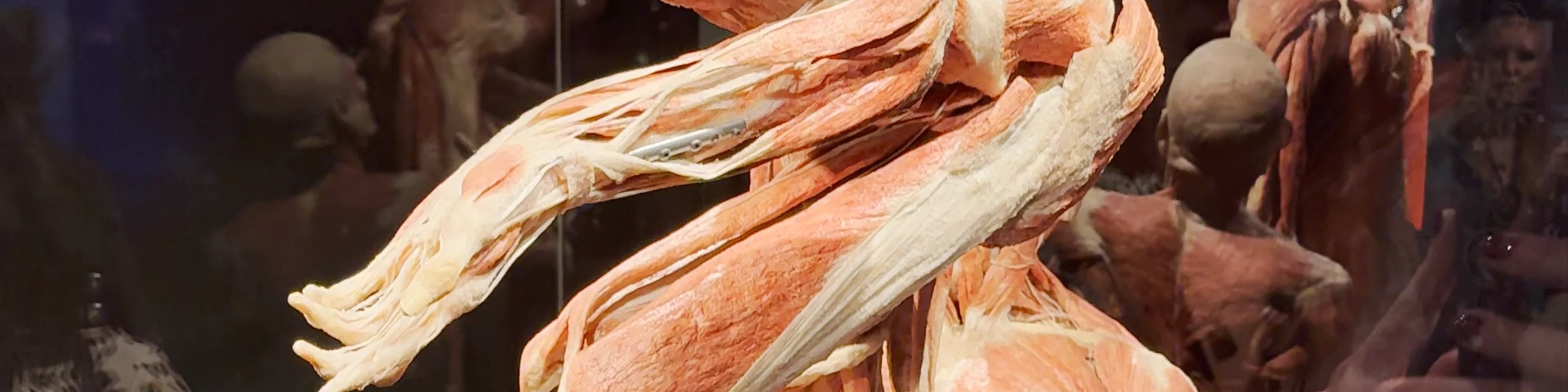 Body Worlds