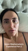 @ashontheglow on what her upper blepharoplasty cost