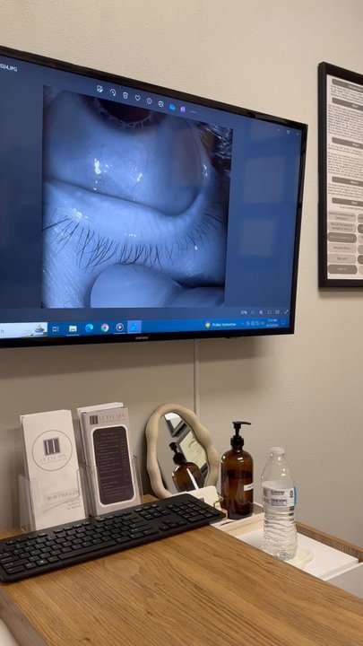 Le Eye Spa - Dr. Tami explaining the close up eye pictures and explaining the results - Optometrists Near Me - Las Vegas, Nevada