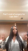 Boss Maxie discusses her planned surgery budget