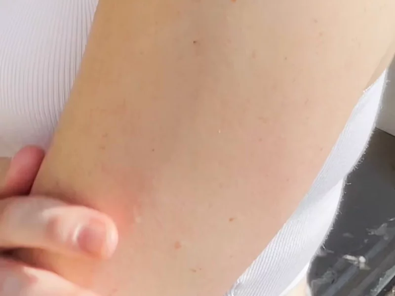 Dermavive