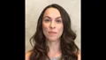 The Perfect Smile - Dr. Michael Kosdon patient on temporary veneers