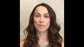 The Perfect Smile - Dr. Michael Kosdon patient on temporary veneers
