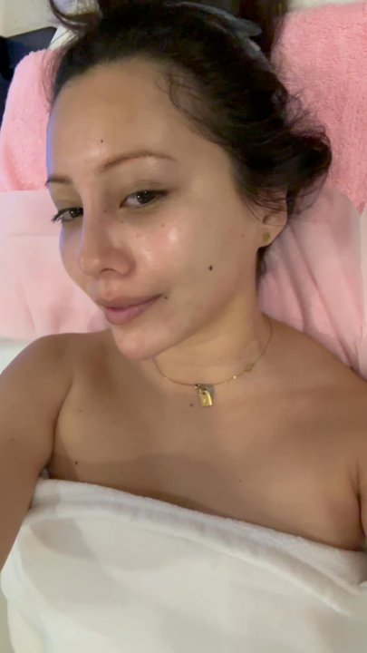 YokoMD - Right after the Deluxe Hydra Facial - Medical Spas Near Me - Pasadena, California