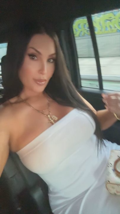 NakedMD - Botox glow ! Love it - Medical Spas Near Me - Glendale, California