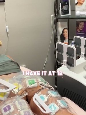 Emsculpt result at Unicorn Medical Weight Loss and Medi Spa