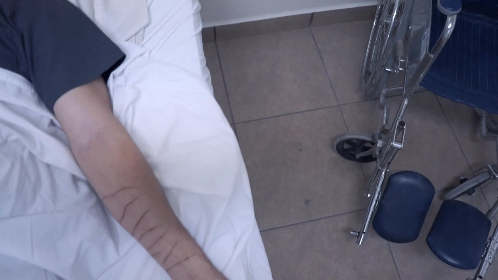 A man lying in a hospital bed contemplates his scarred arm while a woman uses a pendant to perform a healing ritual. The sequence captures the intersection of medical recovery and spiritual practice.