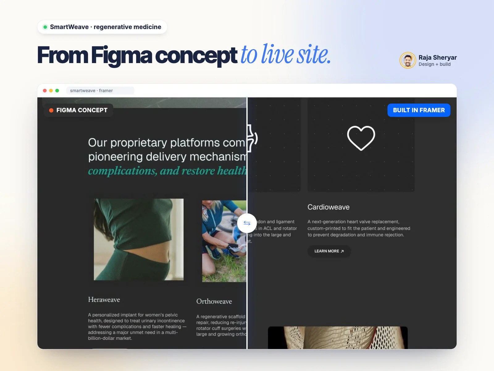 From Figma concept to a live Framer site: SmartWeaveSmartWeave builds AI-driven regenerative therapeutics. I designed the full site in Figma first (dark, scientific, calm), then built it in Framer with native animations, reusable components and CMS for resources and careers.In the video: the Figma file on the left, the live Framer build on the right. The goal on every Figma-to-Framer job is the same: nothing lost in translation, and a site the team can edit on day one.Do you design in Figma first, or straight in Framer?