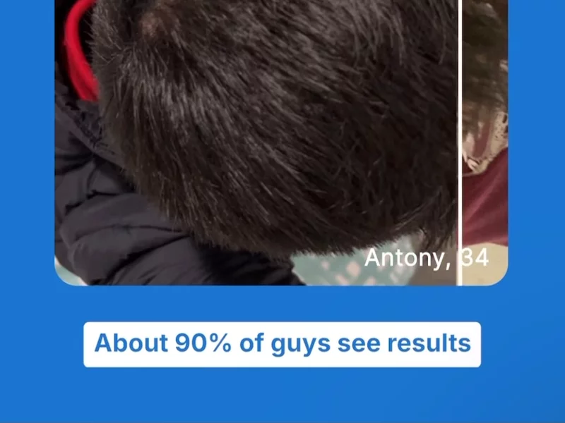 Pilot Hair Loss UGC #1