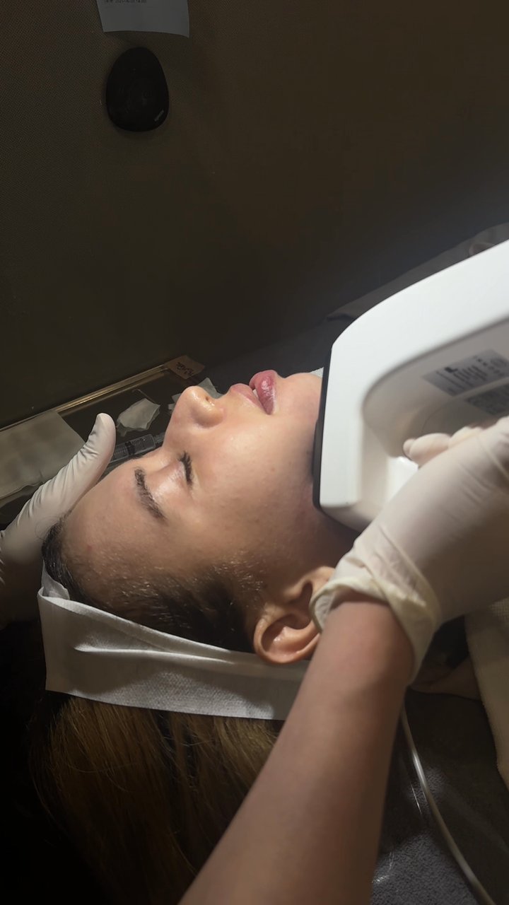 InMode, Microneedling, Double Chin Fat Dissolving, LED, Mask (Benjamin Clinic)