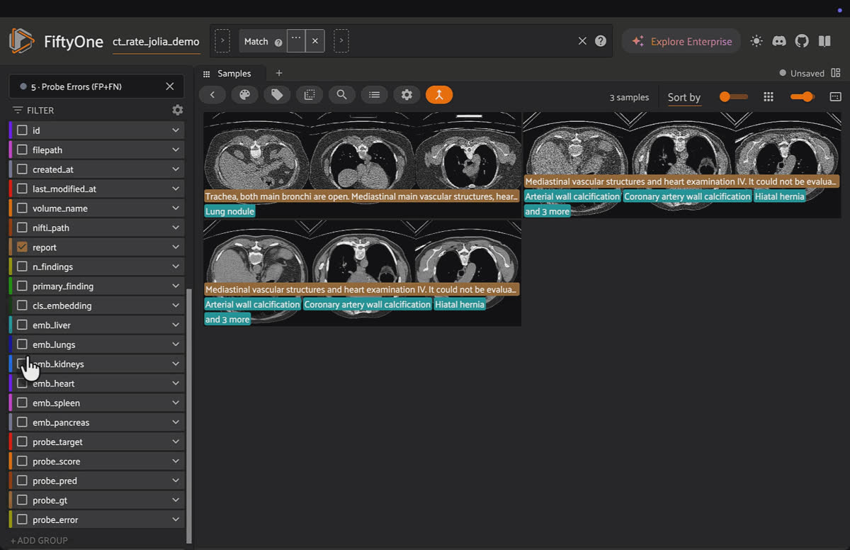 Findings Probe Explorer view, filtered to false positives and false negatives from a linear probe trained on Jolia's frozen [CLS] and lungs embeddings.