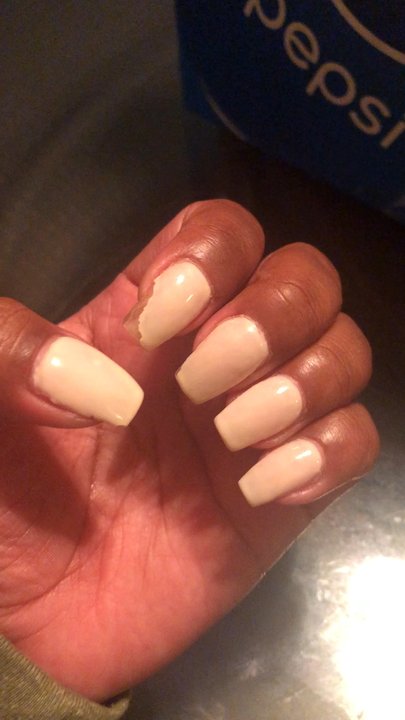Easy Nails And Spa - This is after one day - Nail Salons Near Me - Montebello, California