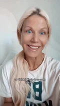 @teresa.collins on cobra neck after a neck lift