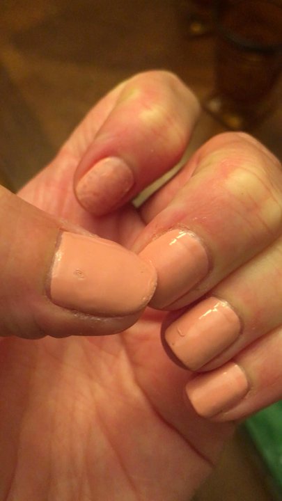 Ooltewah Nail Bar - Proof that they used gel, not the "normal" polish they claimed it was. I wanted gel but was told I grabbed the wrong bottle. Nope. - Nail Salons Near Me - Ooltewah, Tennessee
