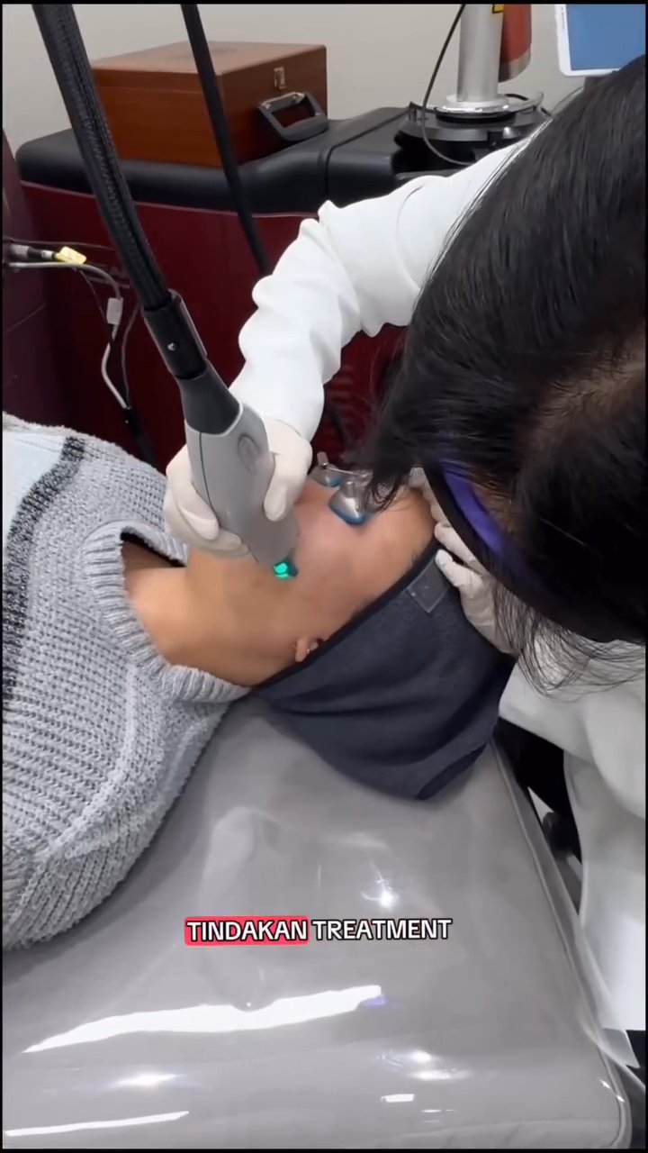 Pico Toning, V-Beam, Wiko Uno, HF Penetration, LBM, Mask (Benjamin Clinic)
