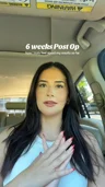 @claireastev, week 6 after breast implant revision