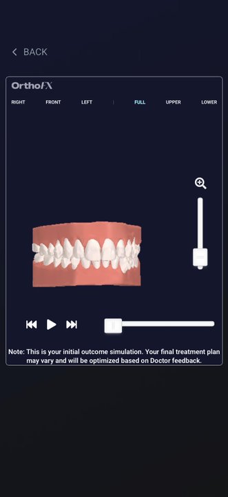 Accu Dental Group - Tracking the progress of my Invisalign with the app Dr Loftus provides - General Dentistry Near Me - Long Beach, California