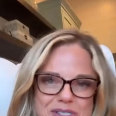 Utah Facial Plastics & UFP Hair Restoration rhinoplasty result — Salt Lake City, UT