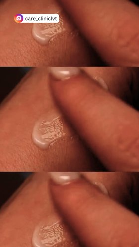 Hand Care